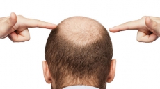 Here Comes A Device To Regrow Hair On Bald Head