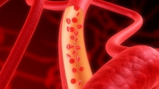 Second-hand marijuana smoke may damage blood vessels