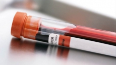 Simple blood test may even predict suicide