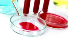 UVic Develops Less-bloody Blood Test That Is Already In Use At Mayo Clinic