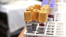 Junk blood tests may reveal resistant skin bacteria