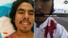 'I Just Got Shot': US Boy Posts Bloody Selfie Immediately After He Was Hit By Arizona Shooting