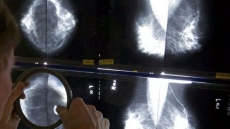 Dim Light Escalates Breast Cancer's Spread To Bones