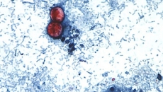 Canada is not banning produce imports amid U.S. cyclosporiasis outbreak, CFIA says