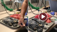 VIDEO: Smoker Vs Non-Smoker Viral Video Will Make You Quit Cigarettes For Good