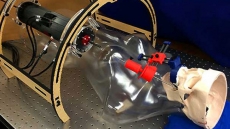 Brain surgery through cheek bone for epilepsy patients