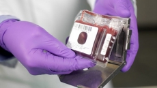 Cord blood donor found for Quebec woman battling leukemia for a second time