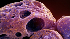 JN.1 represents 'very serious evolution' of Covid virus, say global experts