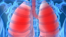 25 years after CF gene isolated, researchers still building on its discovery