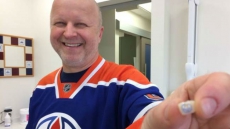 Edmonton Dentist And Big Hockey Fan Crowns Patients With Oilers Logo