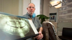 To Fluoridate Or Not To Fluoridate? Municipalities Drinking Up Water Debate