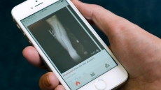 Made-in-Canada Figure 1 app, an 'Instagram for doctors,' not for the squeamish
