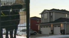 Quebec Woman Needs Extensive Surgery To Head, Face After Mauling By Her Two Dogs