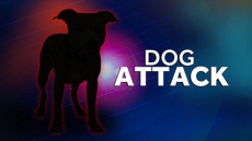 Girl, 3, Required 48 Stitches After Being Bitten On Face By Dog: OPP