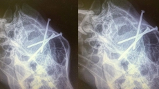 Lost German Shepherd Is Returned To B.C. Owner With Three Nails In Its Head