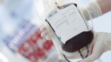 'Newly' donated blood better for heart surgery