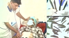 40 Knives Removed From Amritsar Man's Stomach; Says 'Felt Like Eating Them'