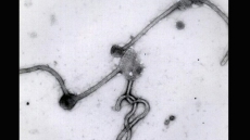 Experts starting to admit it may take vaccine to stop Ebola in West Africa