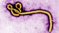 Small Study Suggests Zmapp May Boost Ebola Virus Survival