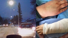 Man, 28, Charged With Breaking Woman's Arms In Road Rage Incident In Edmonton