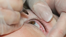 Eyeball tattoos could lead to blindness and severe infections, doctors warn