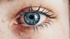 How to deal with itchy eyes