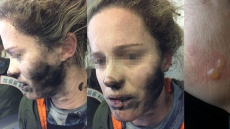 Woman Burned After Headphones Explode On Flight To Australia