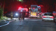 After Her Body Caught Fire, Ottawa Woman Calls For More Safety Regulations