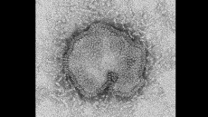 Canada Finds Case Of H7N9 Bird Flu In BC Traveller From China; First In North America