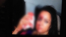 Hema Malini Injured In A Road Accident In Rajasthan