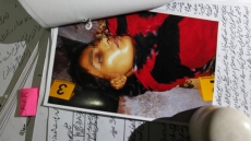 Woman's Eyes Gouged Out, Limb Cut Off By Her Brothers In Pakistan