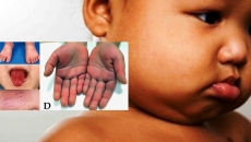 WATCH: Covid related illness spotted in 8 BC children, Hurricane Laura continues to wreak havoc in USA - Canucks back on ice this saturday