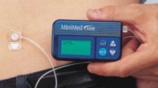 Insulin pumps capable of saving lives: study