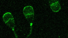 'Killer sperm' stops cross-species mating