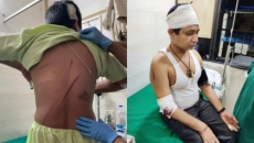 Mumbai shocked as lawyer attacked with swords on road