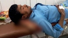 Indian Doctors Suspended After Patient's Amputated Leg Is Used As Pillow (VIDEO)