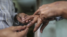 'India will take at least 40 years to eliminate leprosy'