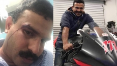 You Bloody Black Indians: Kerala Man Abused, Assaulted At An Australian Restaurant