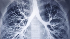 How Fast Are Your Lungs Ageing? Here's The Lowdown