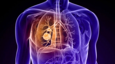 Females sex hormone key to warding off lung infections