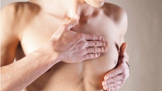 'Include men in breast cancer trials'