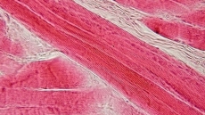 Men have 400 more active genes in muscles than women