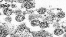 CDC changes, then retracts, its take on coronavirus spread