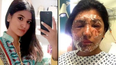 See Pics: London Model Whose Face Was 'Melted' In An Acid Attack Looks Ethereally Beautiful Today