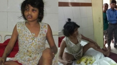 'Mowgli Girl' Who Walks on All Fours Is Found Living with Monkeys in Indian Forest