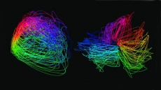 Device to help neuroscientists analyse 'big data'