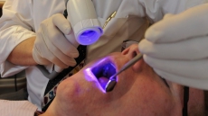 September 11th Is Oral Cancer Screening Day In Surrey