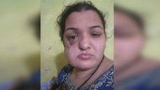 Pakistani Woman With Cancer Asks Sushma Swaraj For Help After Medical Visa Gets Rejected