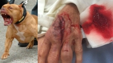 'Aggressive' Pit Bull Attacks Senior, Dog In White Rock, B.C.