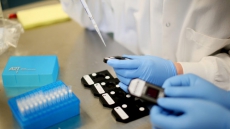 Canadian Task Force Advises Against Screening For Prostate Cancer Using PSA Test